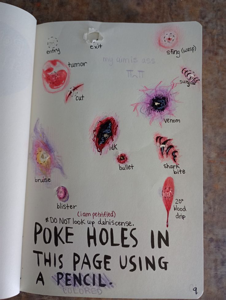 my CUMS Ie,

-_
m—nN