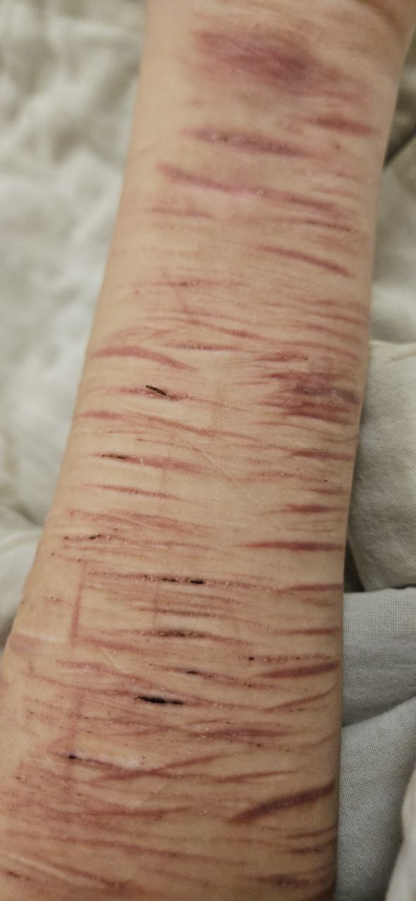 Aren't my scars beautiful?