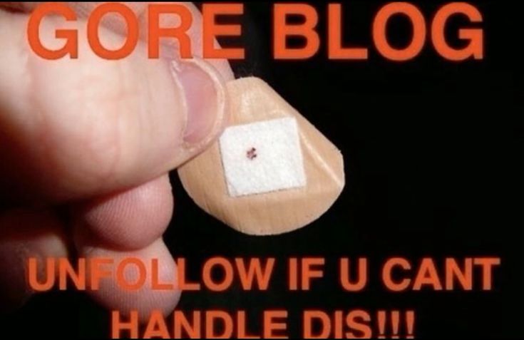 GORE BLOG

UNFOLLOW IF U CANT
HANDLE DIS!!!