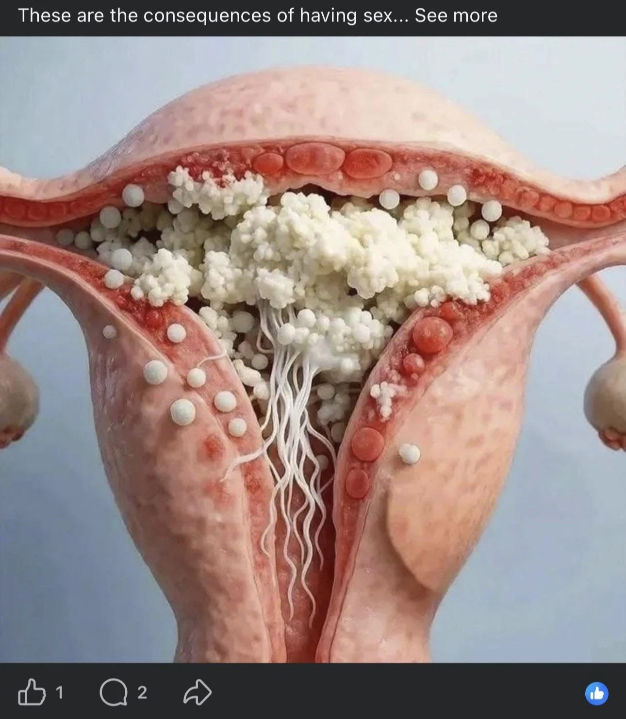 These are the consequences of having sex... See more