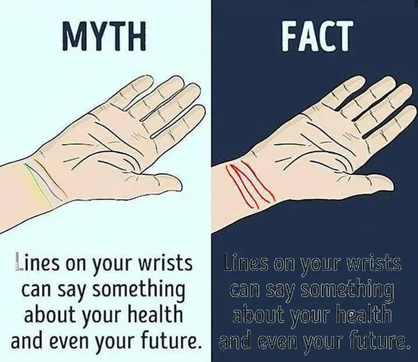 MYTH
FACT

Lines on your wrists
can say something
about your health
and even your future.