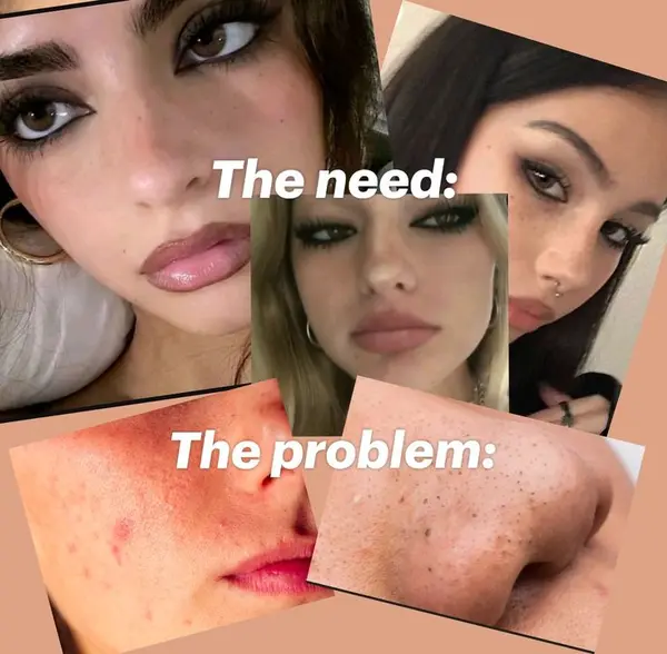 The need:

The problem: